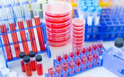 進(jìn)口細(xì)胞清關(guān)需要哪些資料，了解一下！